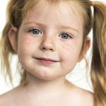 Przebarwienia na skórze - jak się ich pozbyć